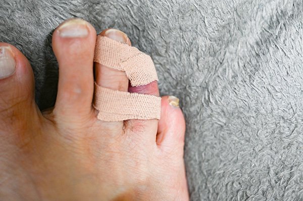 軽傷だったようです。